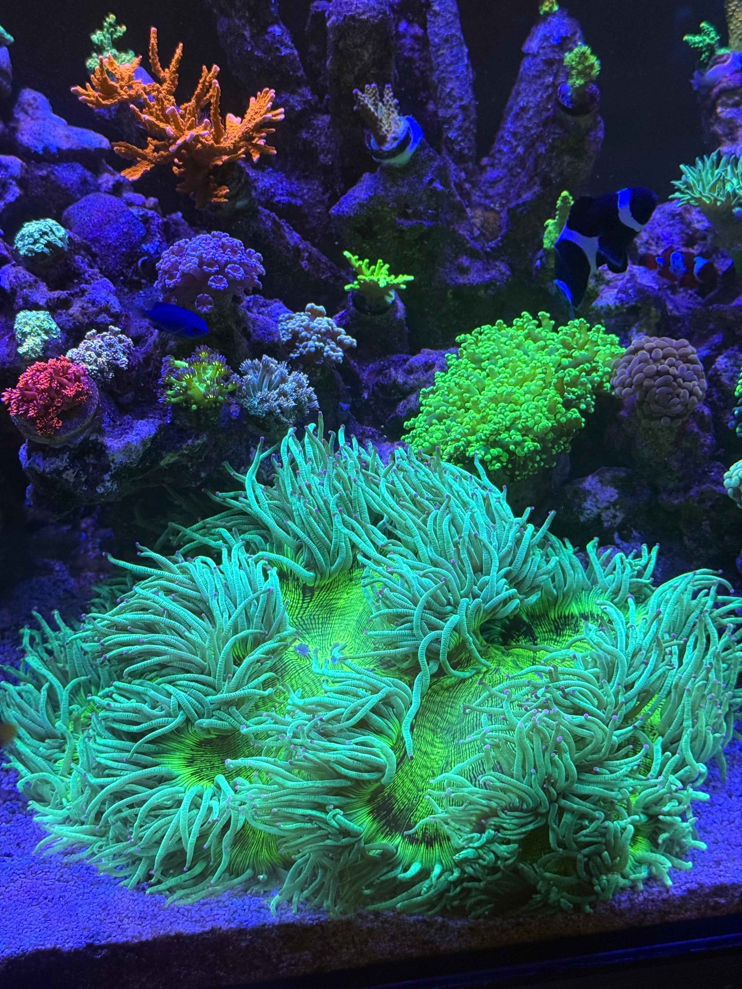 Massive Pink Tip Elegance (Cultured)